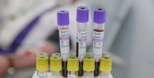 К механизму COVAX присоединились 64 страны с высокими доходами