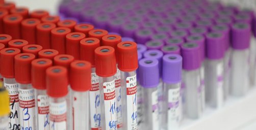 В Беларуси выздоровели и выписаны 68 839 пациентов с COVID-19